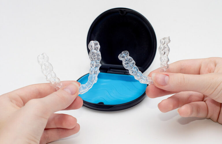 Invisalign dientes: La solución moderna para una sonrisa perfecta ...
