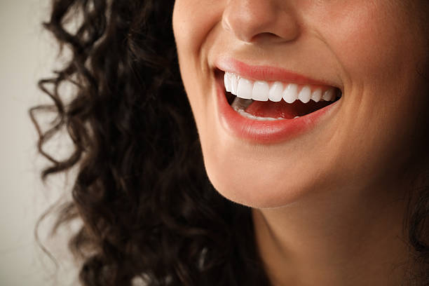 Primer plano de sonrisa perfecta con carillas dentales de porcelana