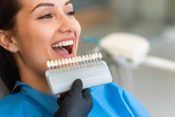 Paciente en clínica dental comparando tonos para carillas dentales con guía de colores