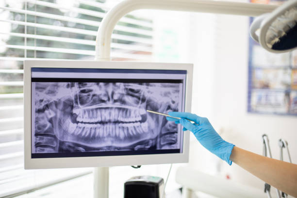 Dentista señalando radiografía panorámica dental en pantalla durante consulta de segunda opinión 